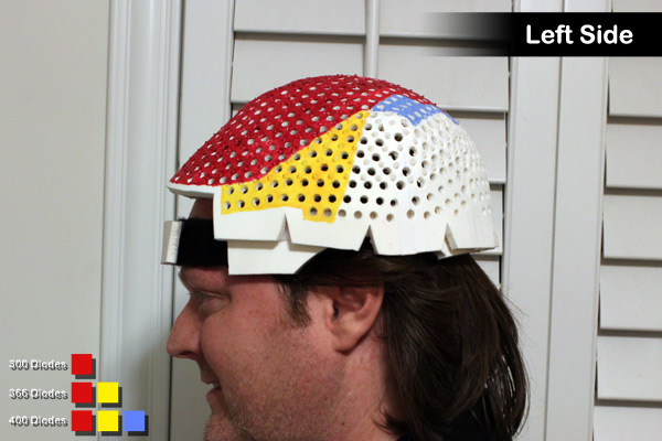 Left side view of a Laser Messiah LLLT device for hair loss on OverMachoGrande's head.